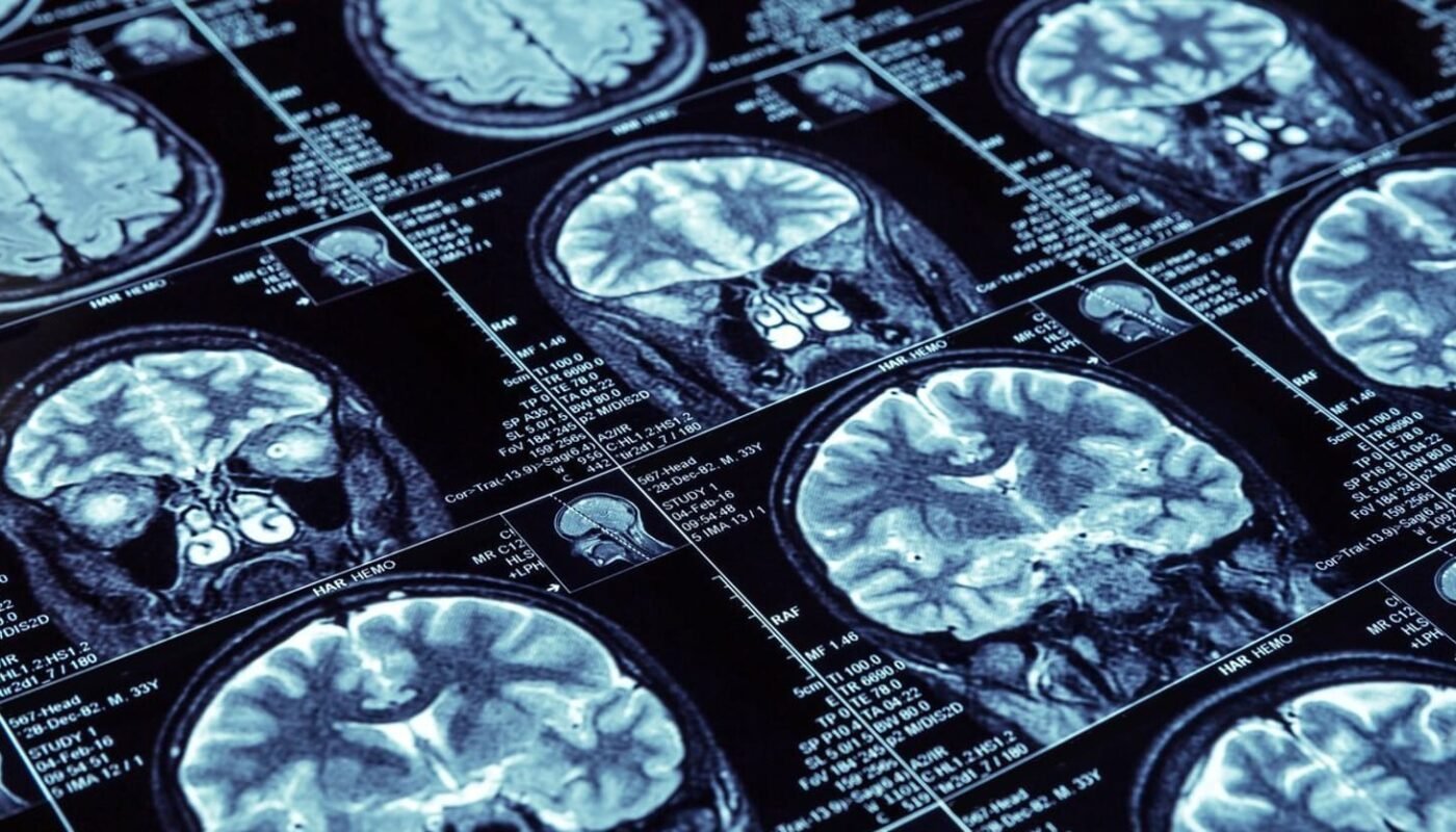 Deep Learning for Medical Diagnosis and Prognosis