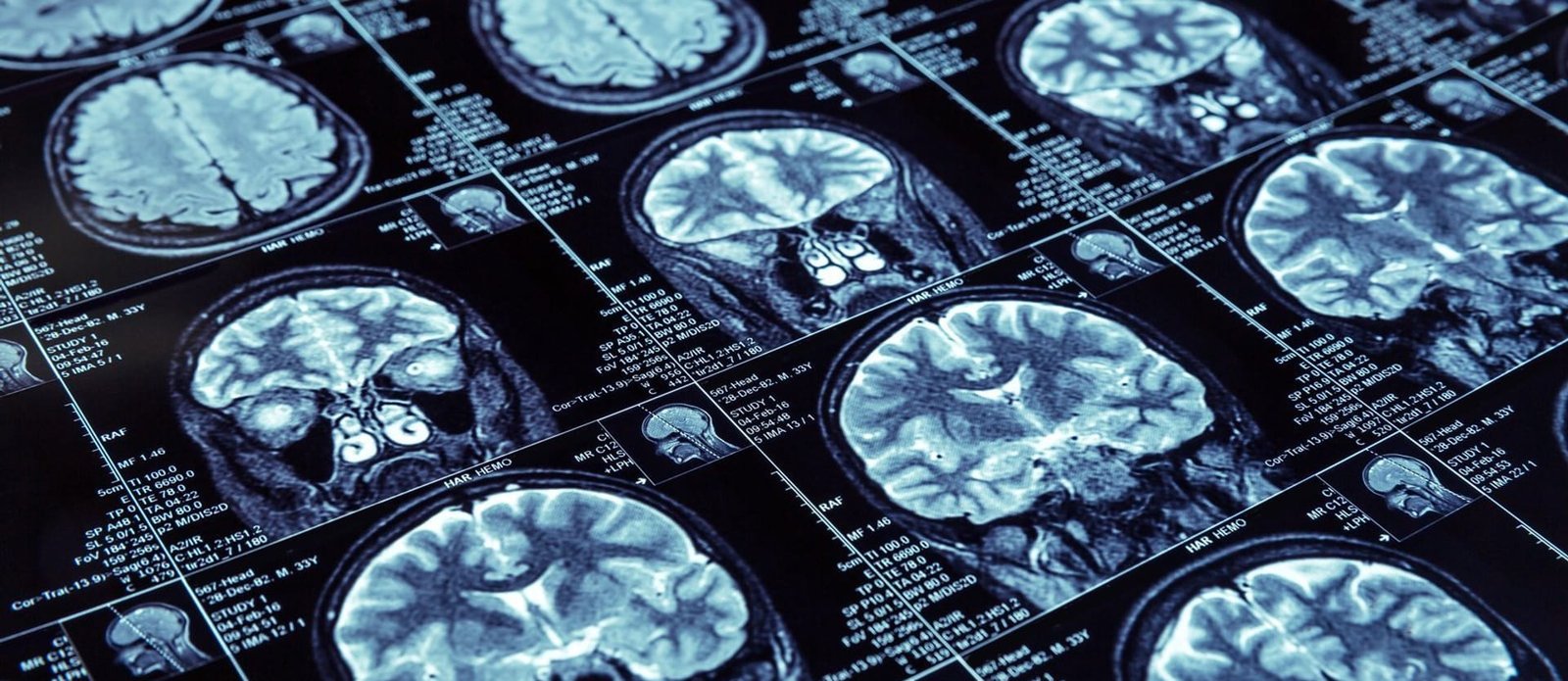 Deep Learning for Medical Diagnosis and Prognosis